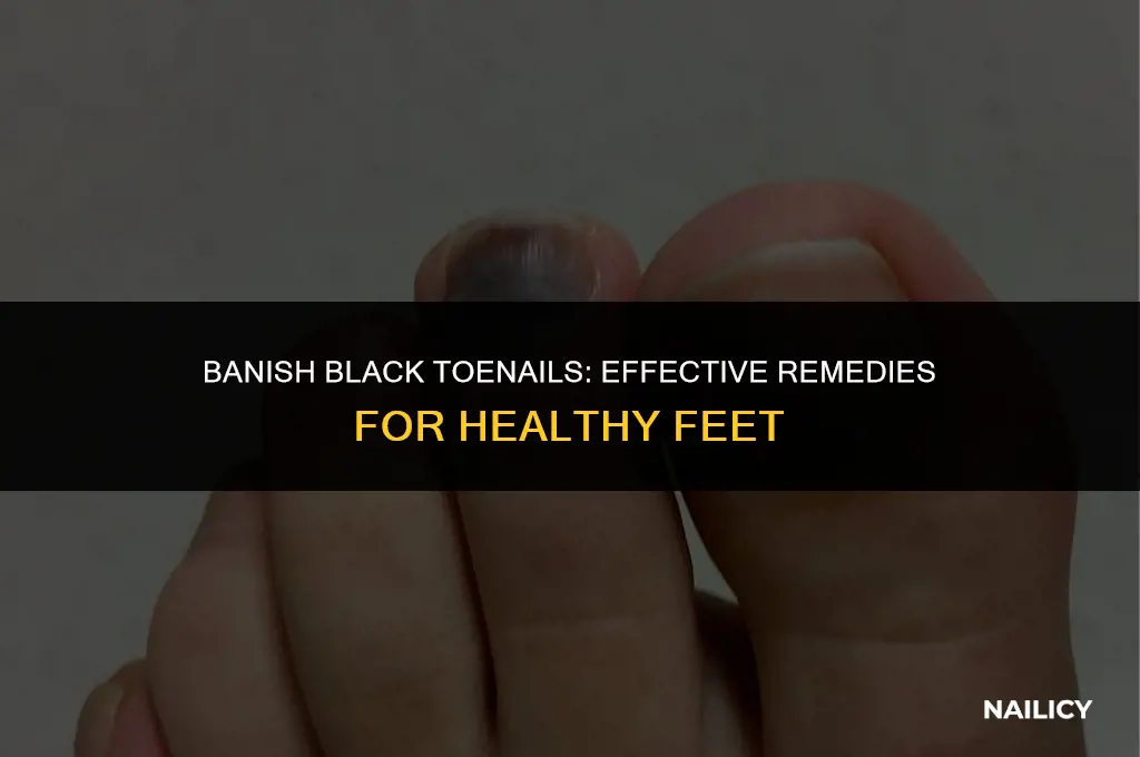 how do i get rid of my black toe nails