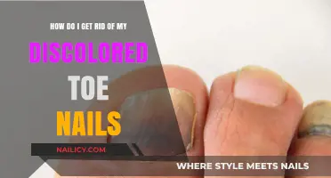 Banish Discolored Toenails: A Comprehensive Guide to Healthy Feet