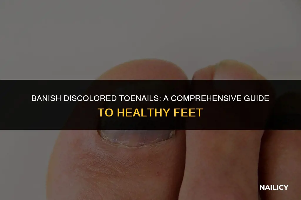 how do i get rid of my discolored toe nails