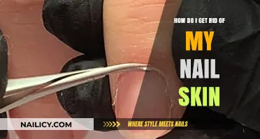 Banish Nail Skin: A Comprehensive Guide to Smooth, Healthy Nails