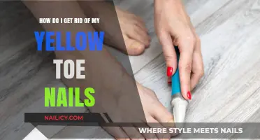 Banish Yellow Toenails: A Comprehensive Guide to Healthy Feet