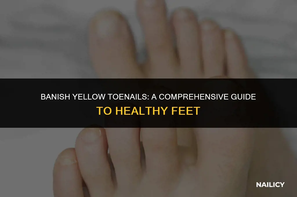 how do i get rid of my yellow toe nails