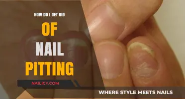 Smooth Nails Ahead: Effective Ways to Banish Nail Pitting