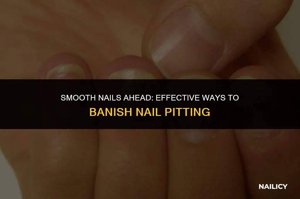 how do i get rid of nail pitting