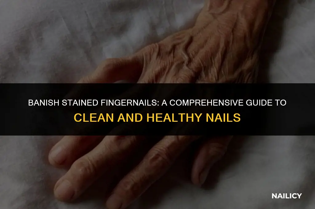 how do i get rid of staine d finger nails