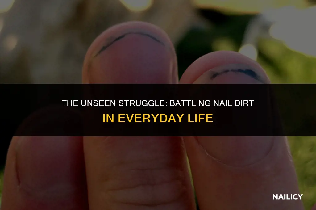 how do i get so much dirt under my nails