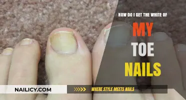 Brighten Your Toenails: A Guide to Achieving Pristine White Nails