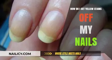Banish Yellow Stains: A Guide to Bright, Healthy Nails