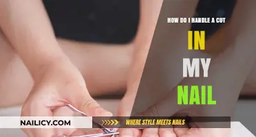 Treating a Cut in Your Nail: Quick Tips
