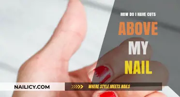 Understanding Nail Bed Injuries: Cuts Above Your Nails