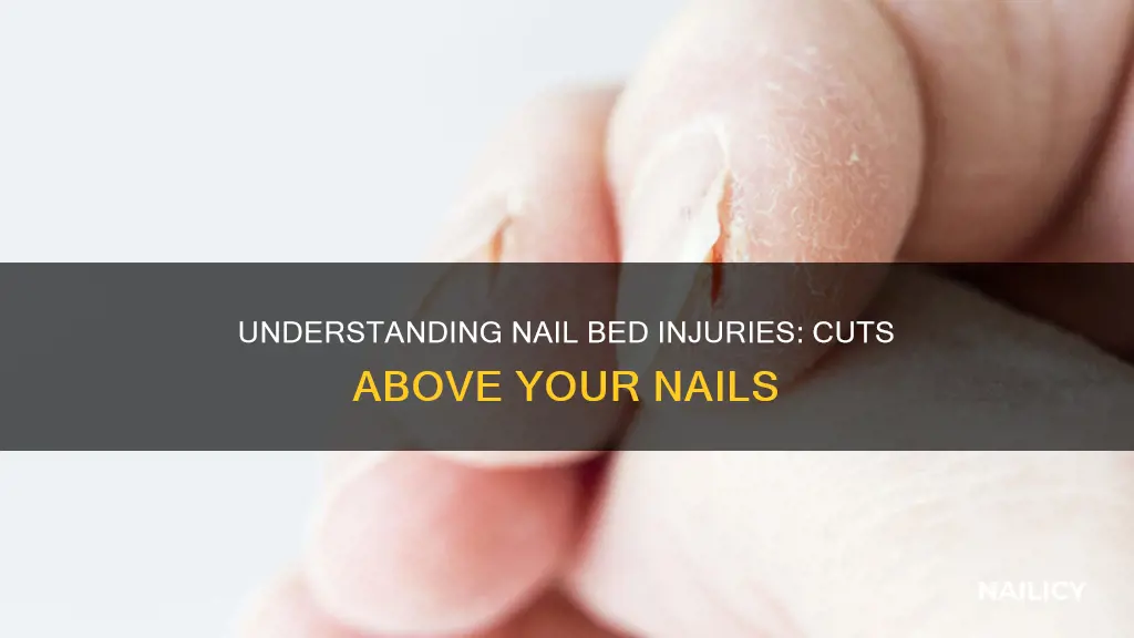 how do i have cuts above my nail
