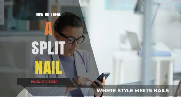 Heal Your Split Nail: Quick Fixes and Long-Term Care Tips
