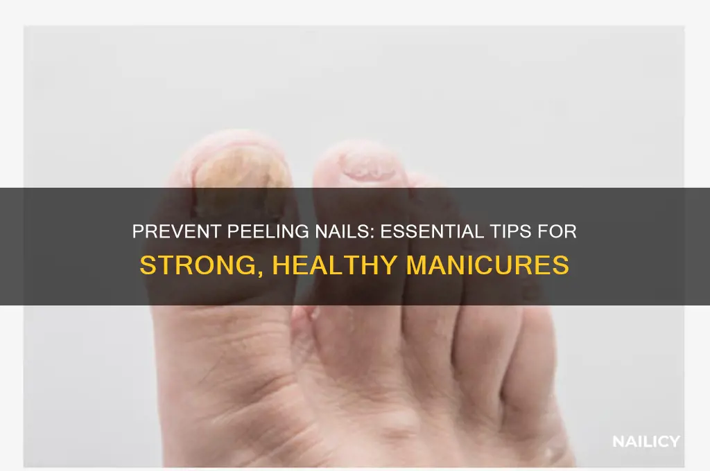 how do i keep my nails from peeling