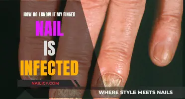 Nail Infection Signs: Spotting the Red Flags