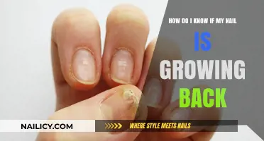 Recognizing Nail Growth: What to Look For