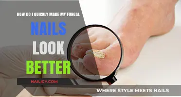 Quick Fixes for Fungal Nails: Improving Appearance