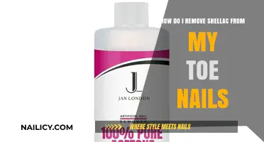 Toe Nail Shellac Removal: DIY Guide