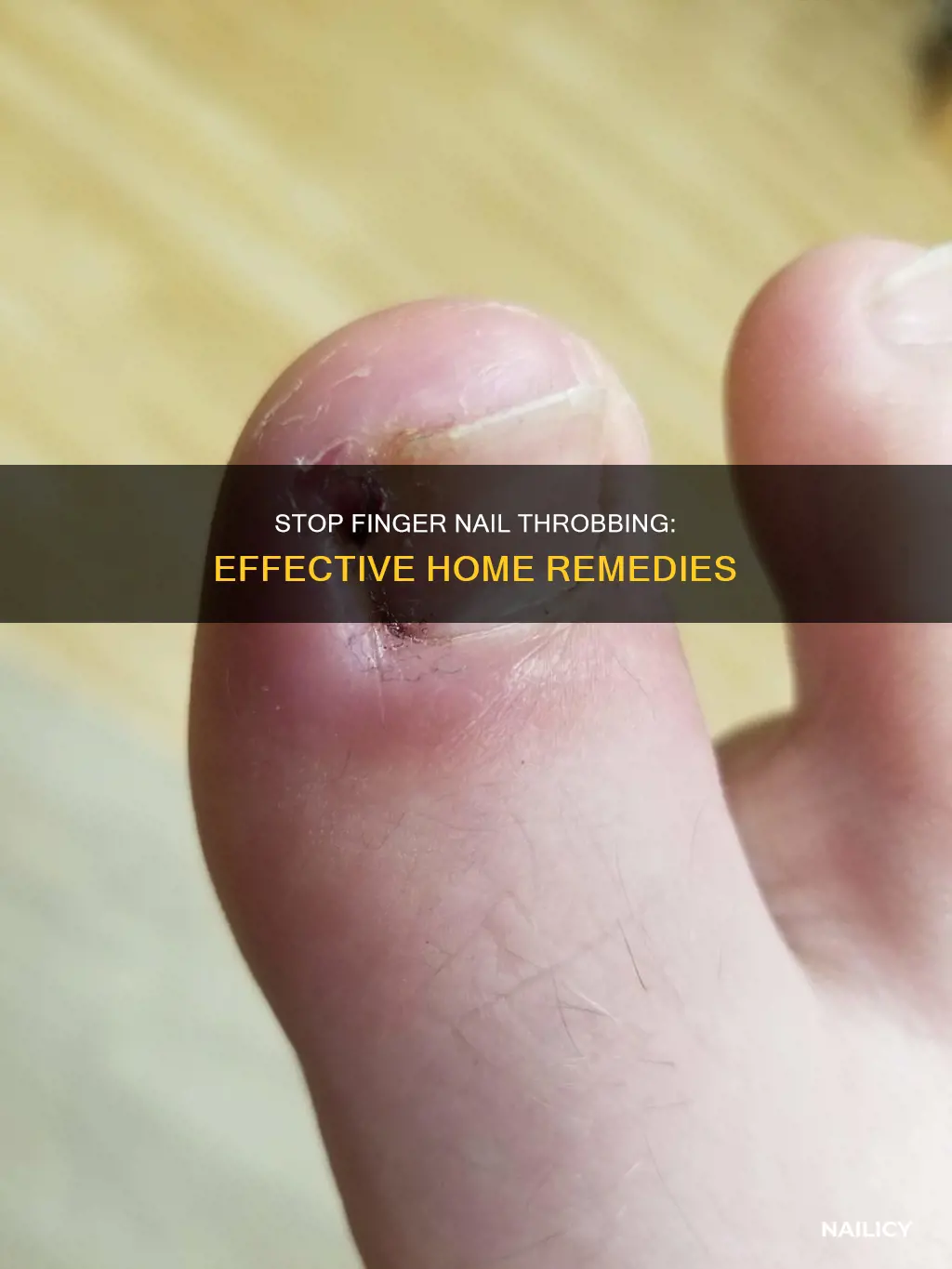 how do i stop my finger nail from throbbing