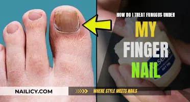 Fungus Under My Nail: Treatment Tips and Tricks