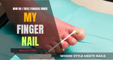 Treating Stubborn Nail Fungus: Effective Home Remedies