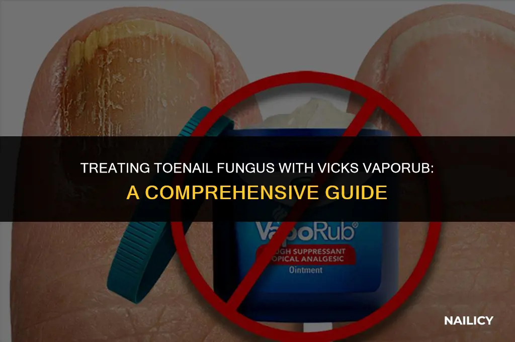how do i use vicks vaporub for toe nail fungus