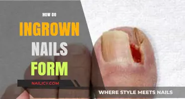 Understanding Ingrown Nails: Causes, Formation, and Prevention Tips