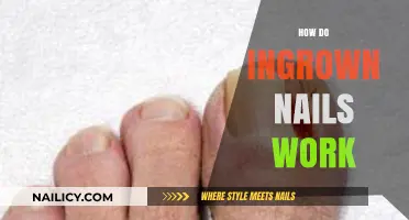 Understanding Ingrown Nails: Causes, Symptoms, and Effective Treatment Options