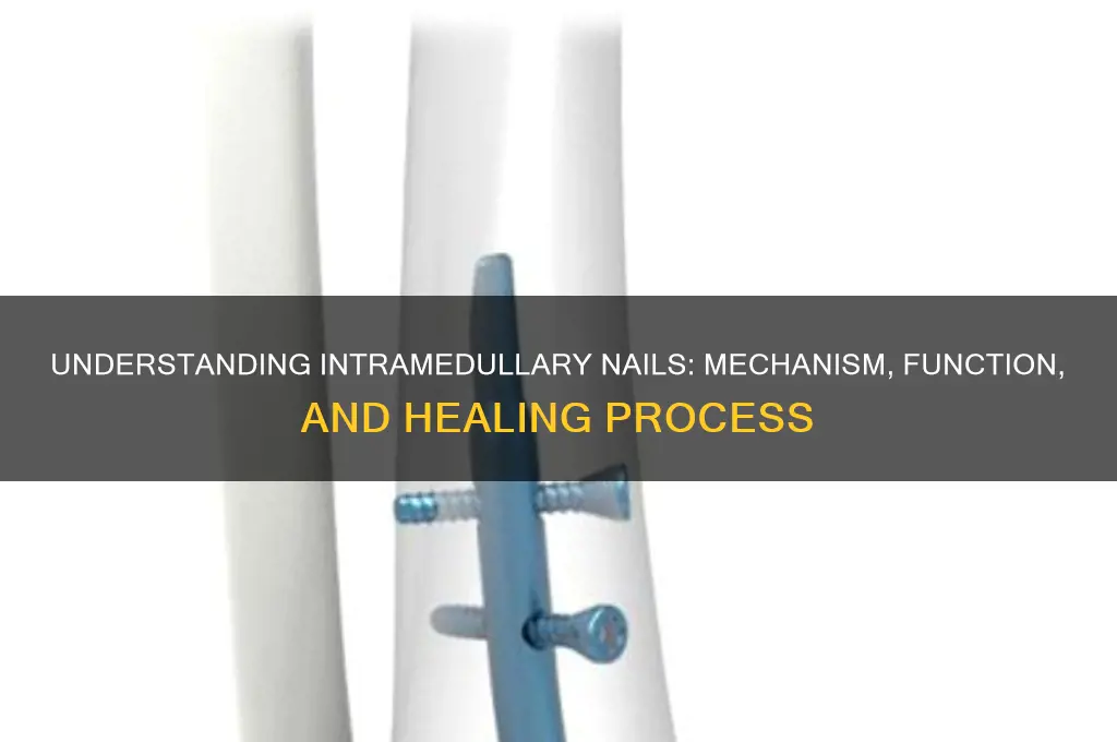 how do intramedullary nails work