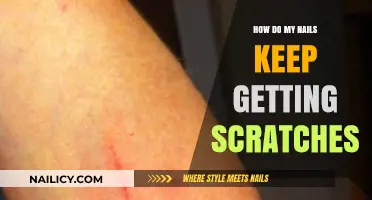 Nail SOS: Tips to Prevent and Repair Scratches