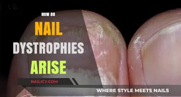 Understanding Nail Dystrophies: Causes, Symptoms, and Prevention Tips