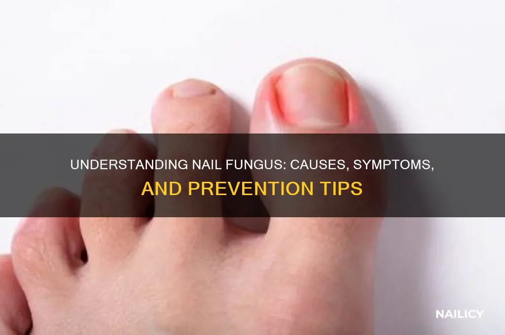 how do nail fungi start