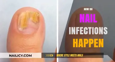 Understanding Nail Infections: Causes, Risks, and Prevention Tips