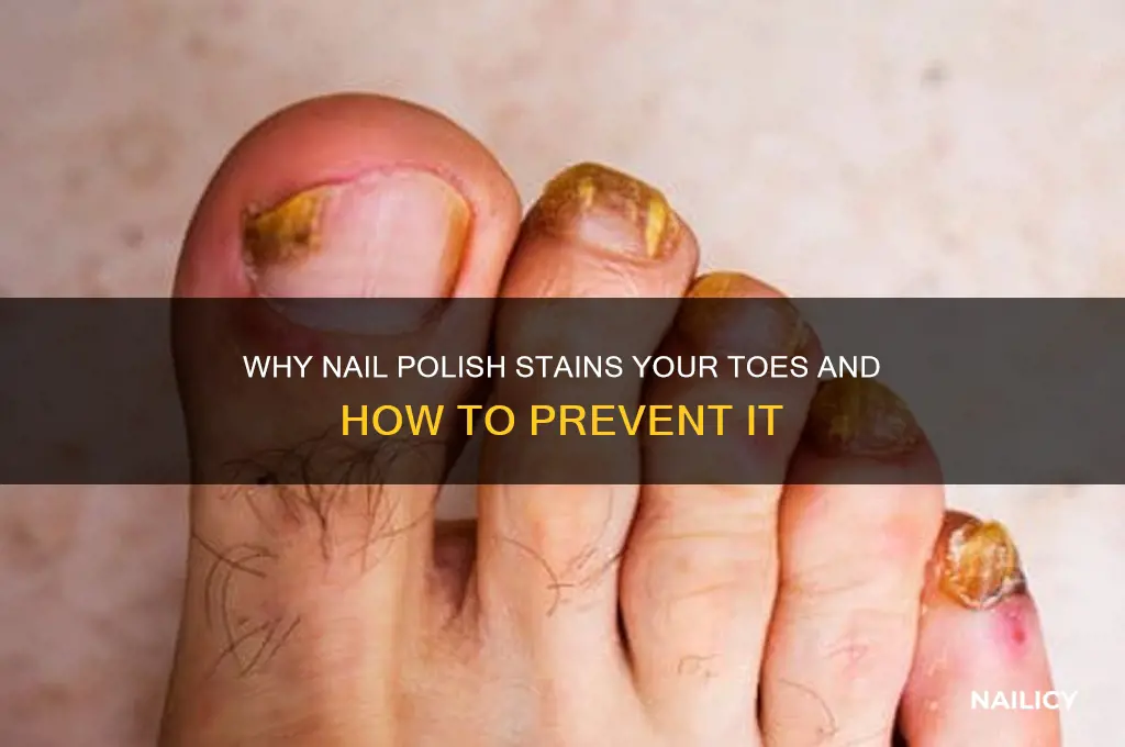 how do nail polish stains your toes