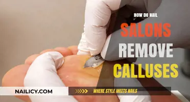 Effective Callus Removal Techniques Used by Nail Salons