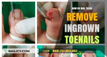 Expert Ingrown Toenail Removal: A Nail Tech's Guide