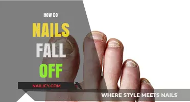 Why Nails Fall Off: Causes, Prevention, and Recovery Explained