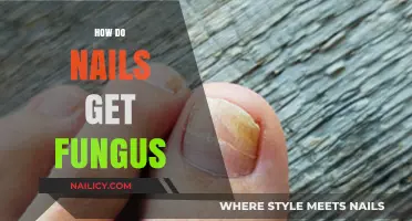 Understanding Nail Fungus: Causes, Symptoms, and Effective Treatments