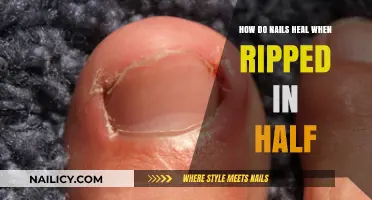 Nail Healing Process: Repairing Ripped Nails and Restoring Strength