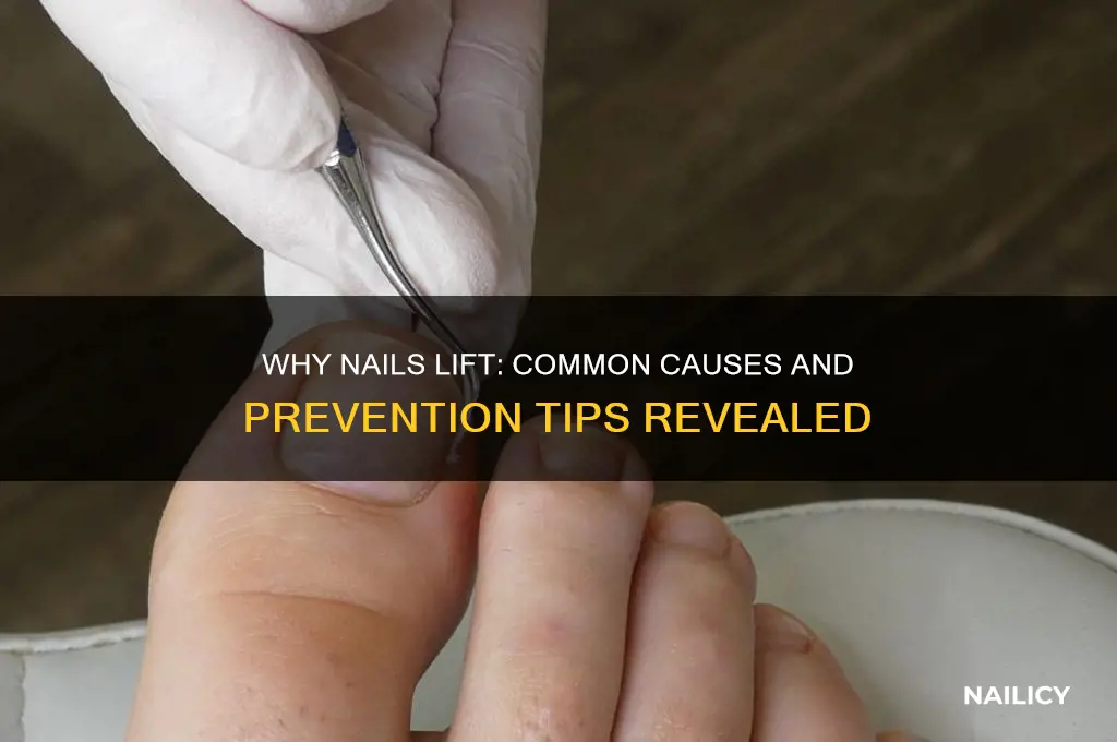 how do nails start lifting