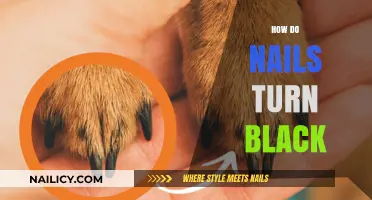Why Nails Turn Black: Causes, Symptoms, and Treatment Options Explained