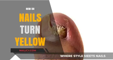 Why Nails Turn Yellow: Causes, Prevention, and Treatment Options