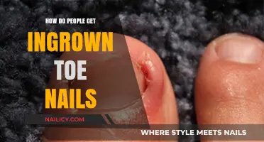 Understanding Ingrown Toenails: Causes, Prevention, and Treatment