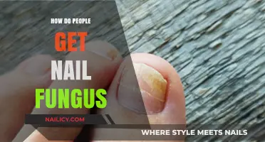 Understanding Nail Fungus: Causes, Symptoms, and Prevention Tips