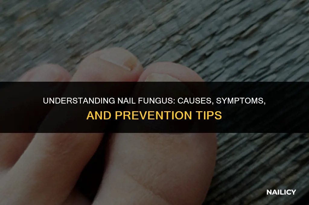how do people get nail fungus