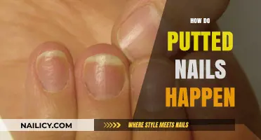 Understanding Putted Nails: Causes, Prevention, and Quick Fixes Explained