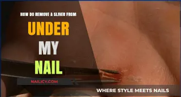 Extracting Slivers: Quick and Safe Removal from Under Nails