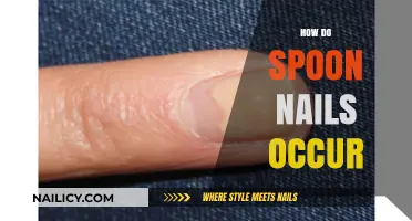 Understanding Spoon Nails: Causes, Symptoms, and Treatment Options Explained