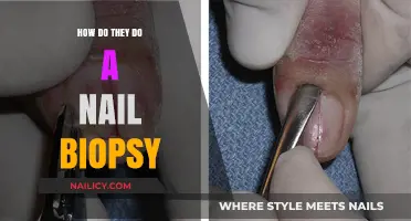Understanding Nail Biopsy: Procedure, Purpose, and What to Expect