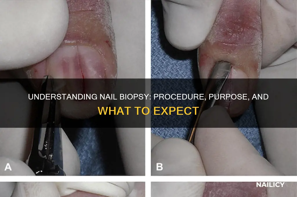how do they do a nail biopsy