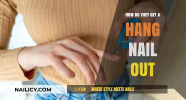 Treating Hangnails: A Step-by-Step Guide for Quick Relief